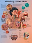 Respiratory Tract Infections - Anatomical Chart